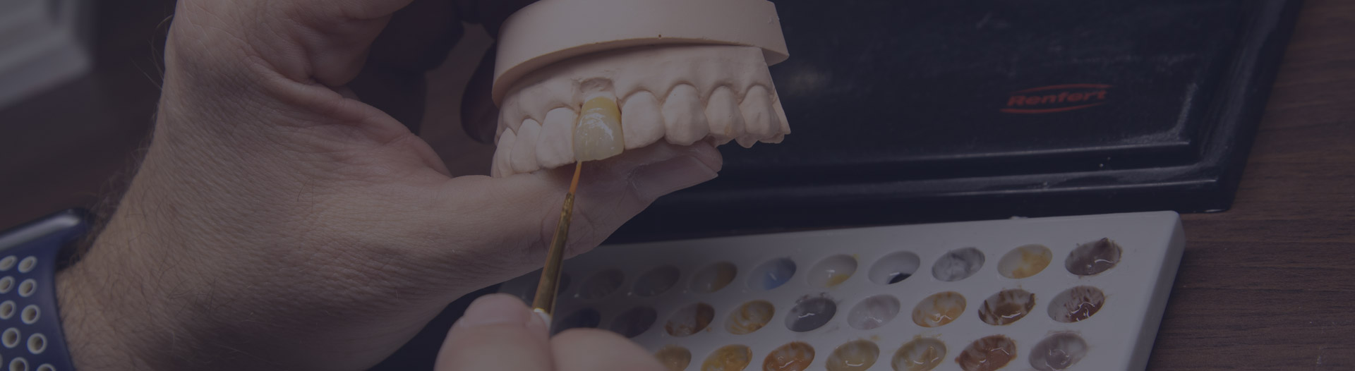 Our Products Synergy Ceramics